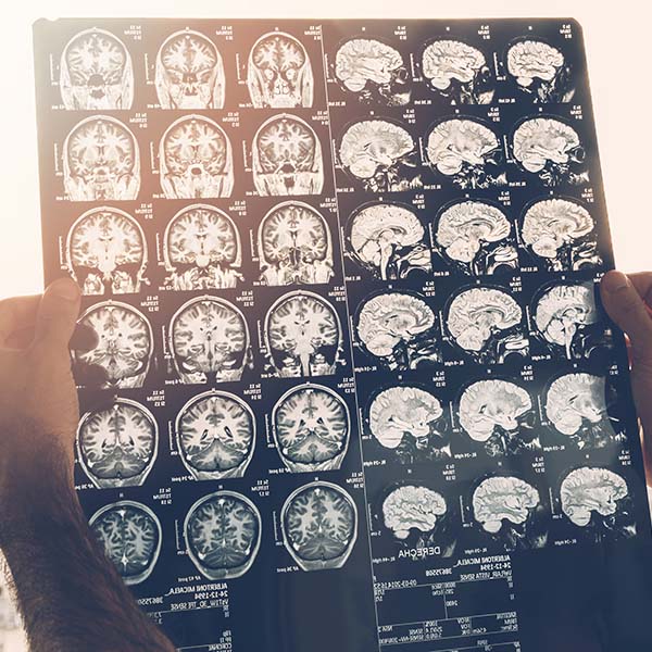 Medical Images
